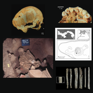 Patterns of Disease and Culture in Ancient Panama A Bioarchaeological Analysis of the Early Graves at Cerro Juan Díaz